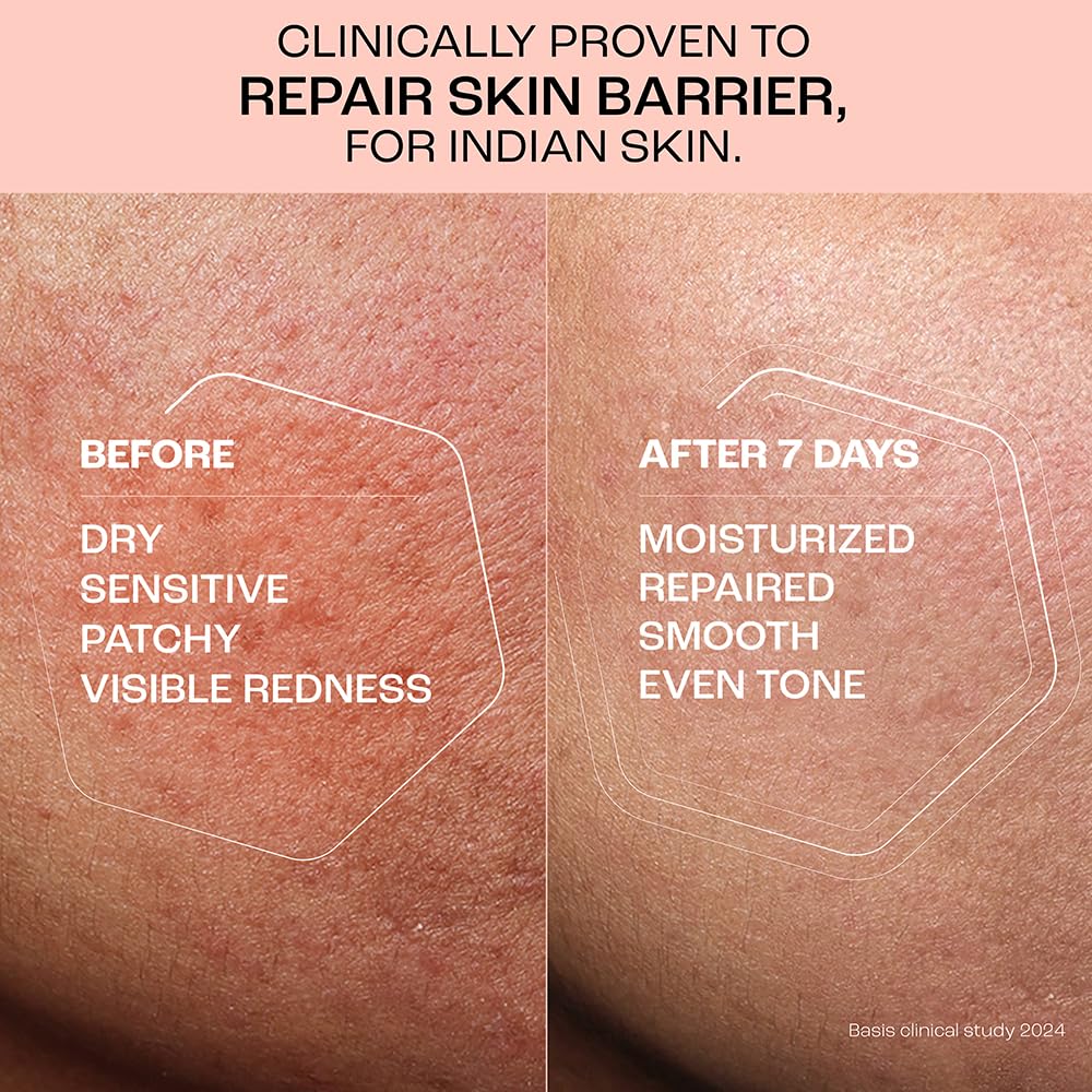 Before and after comparison of skin barrier repair with text indicating clinical proven results for Indian skin.