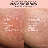 Before and after comparison of skin barrier repair with text indicating clinical proven results for Indian skin.
