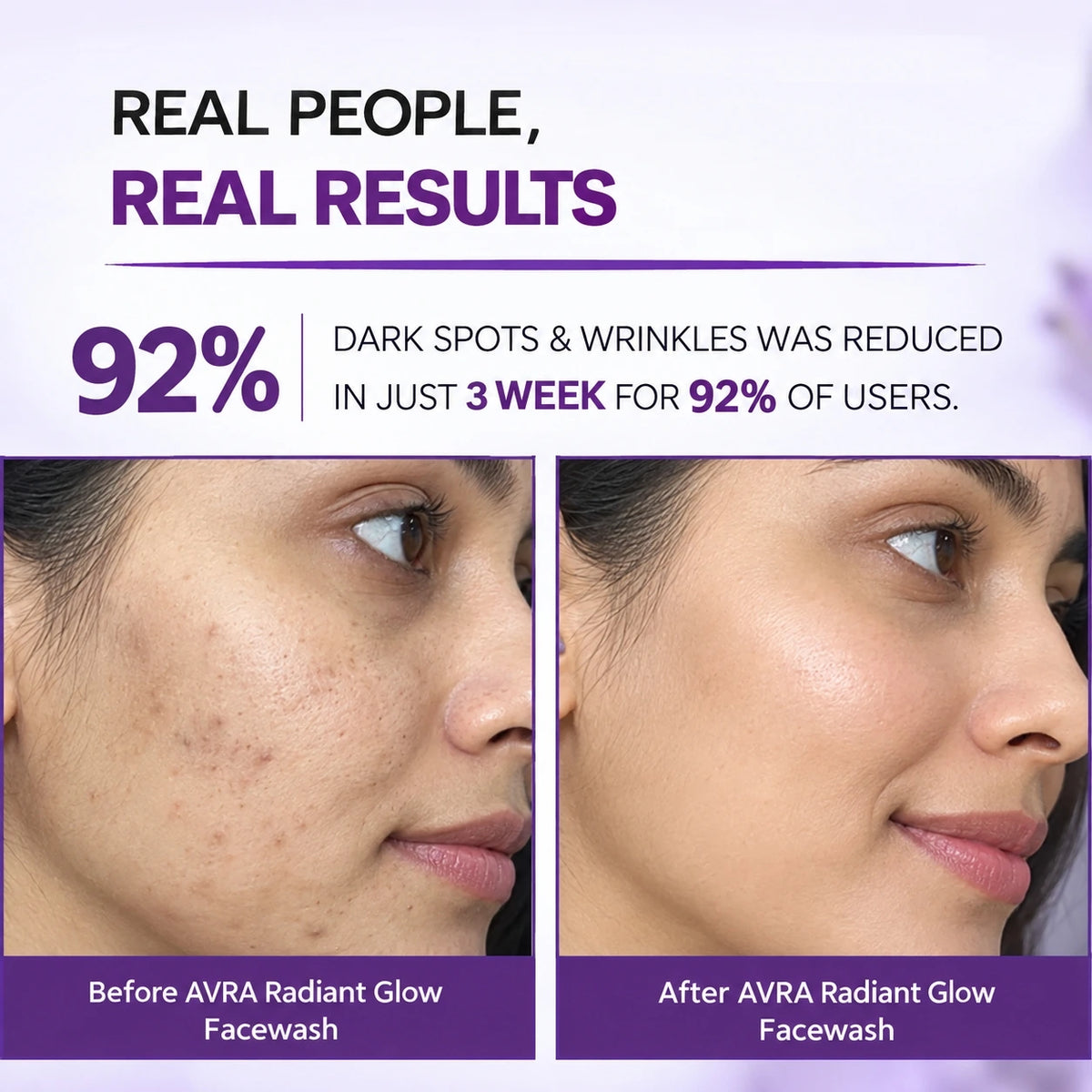 Promotional before-and-after comparison graphic for AVRA Radiant Glow Facewash